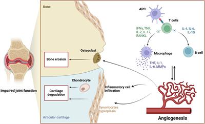 The protective effect of natural medicines in rheumatoid arthritis via inhibit angiogenesis